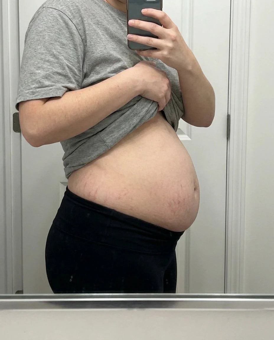 Profil d'un ventre quelques semaines après l'accouchement, photo miroir
